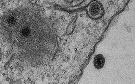 Обнаружен вирус, не несущий известных генов